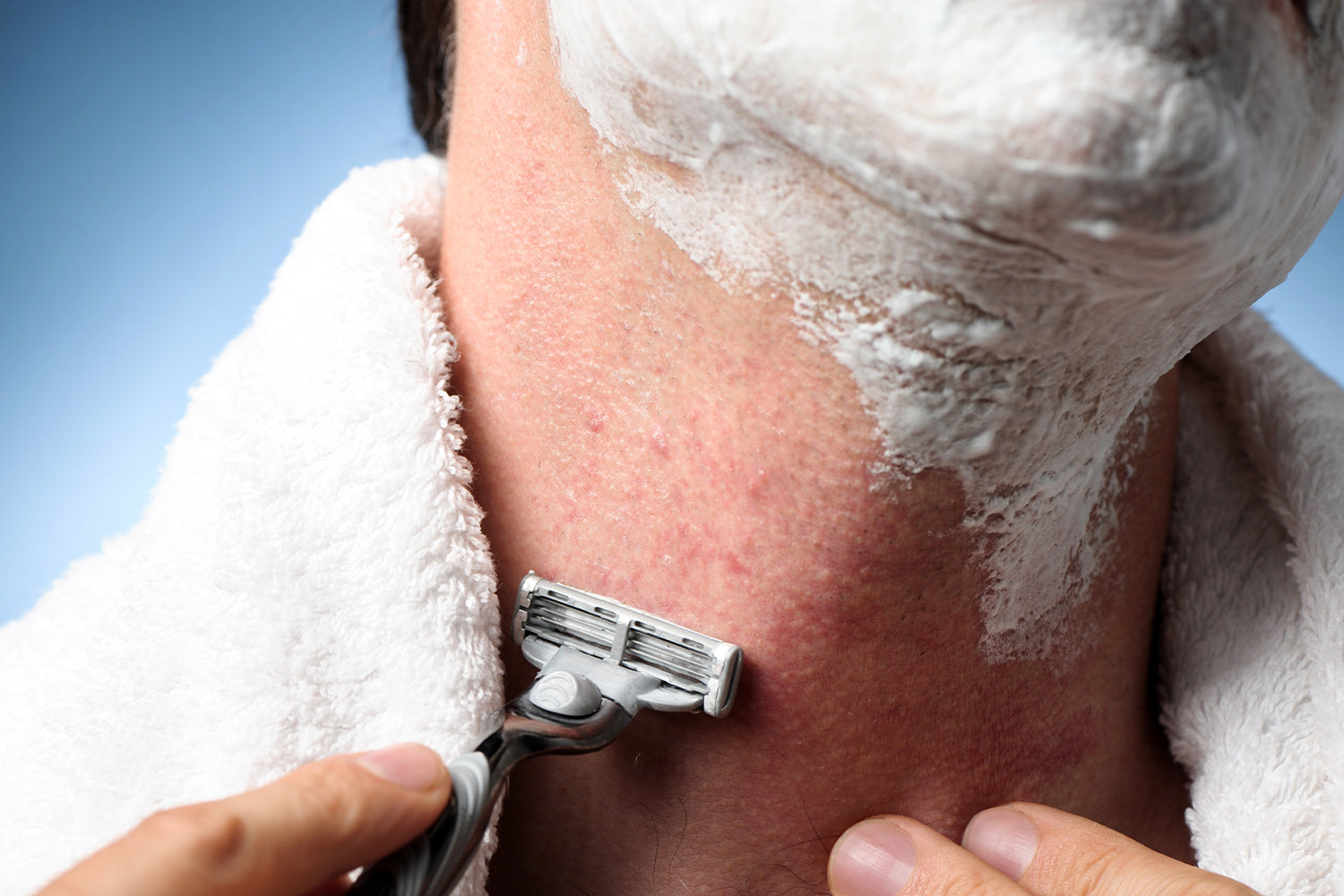 How to Get Rid of Razor Bumps in 10 Steps
